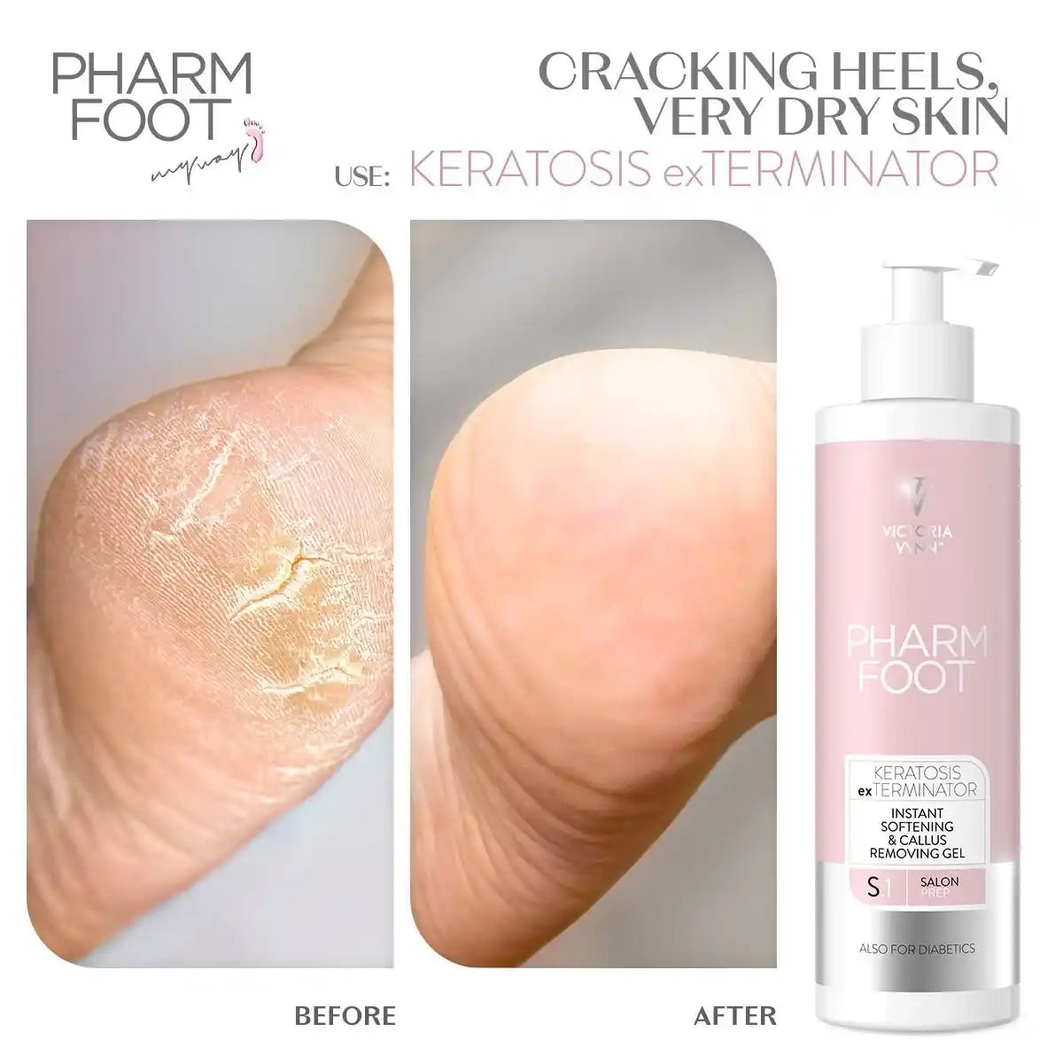 Victoria Vynn - PHARM FOOT ALL IN KERATOSIS exTERMINATOR 300ml